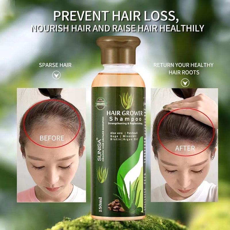 Sunisa Hair Grower Shampoo | Promote hair growth - Zari Villas