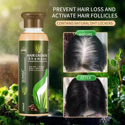 Sunisa Hair Grower Shampoo | Promote hair growth - Zari Villas